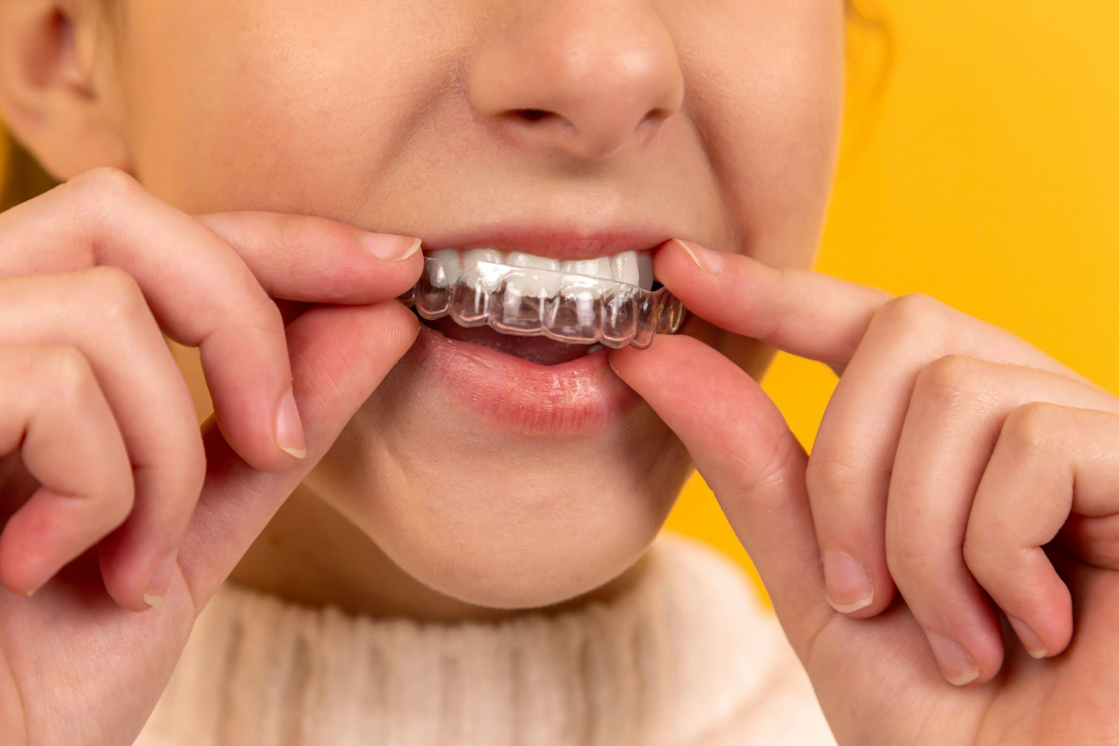 Orthodontics · Invisalign
